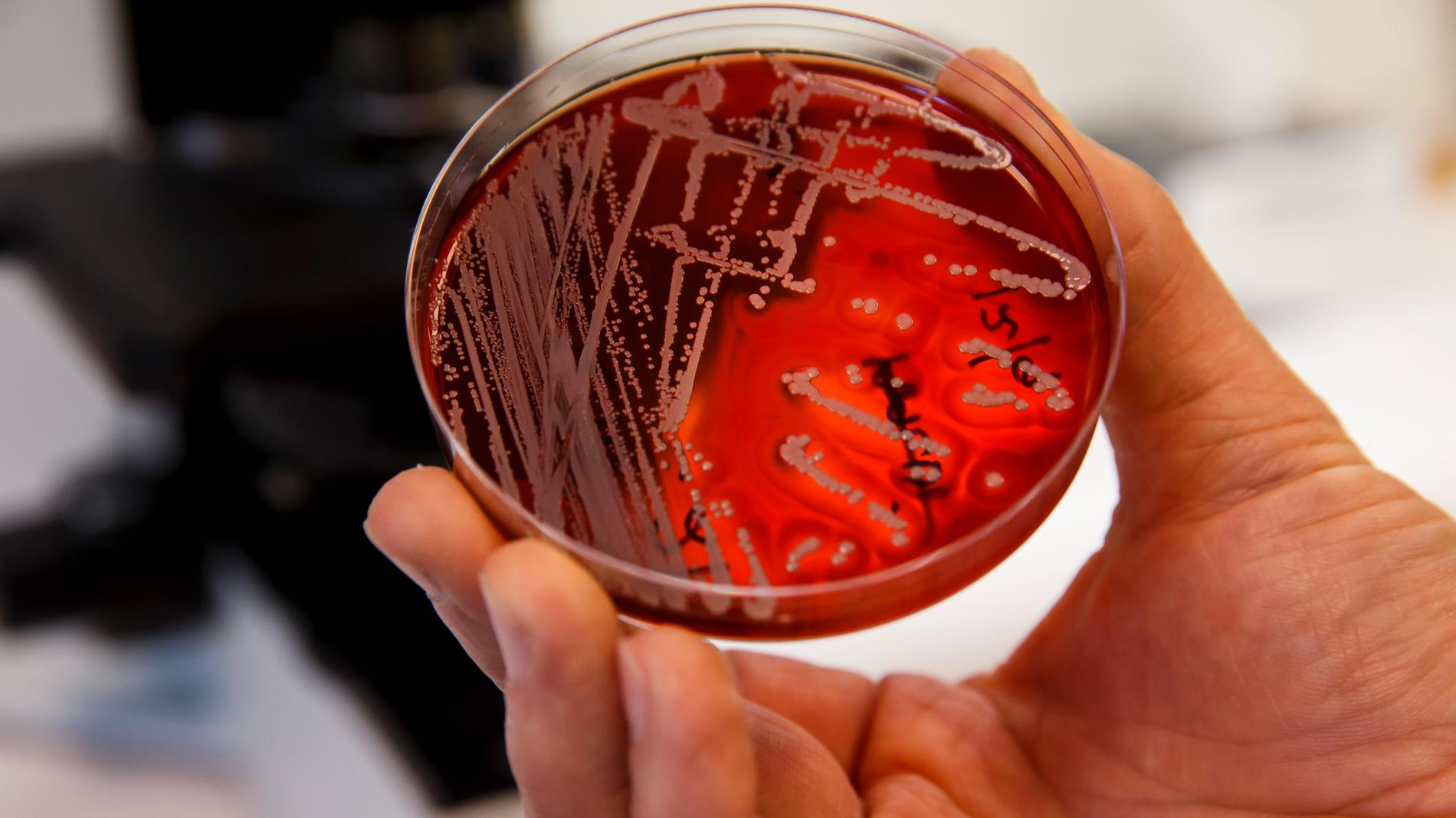 Resistenta bakterier orsakar redan i dag 700 000 människors död varje år, enligt FN.