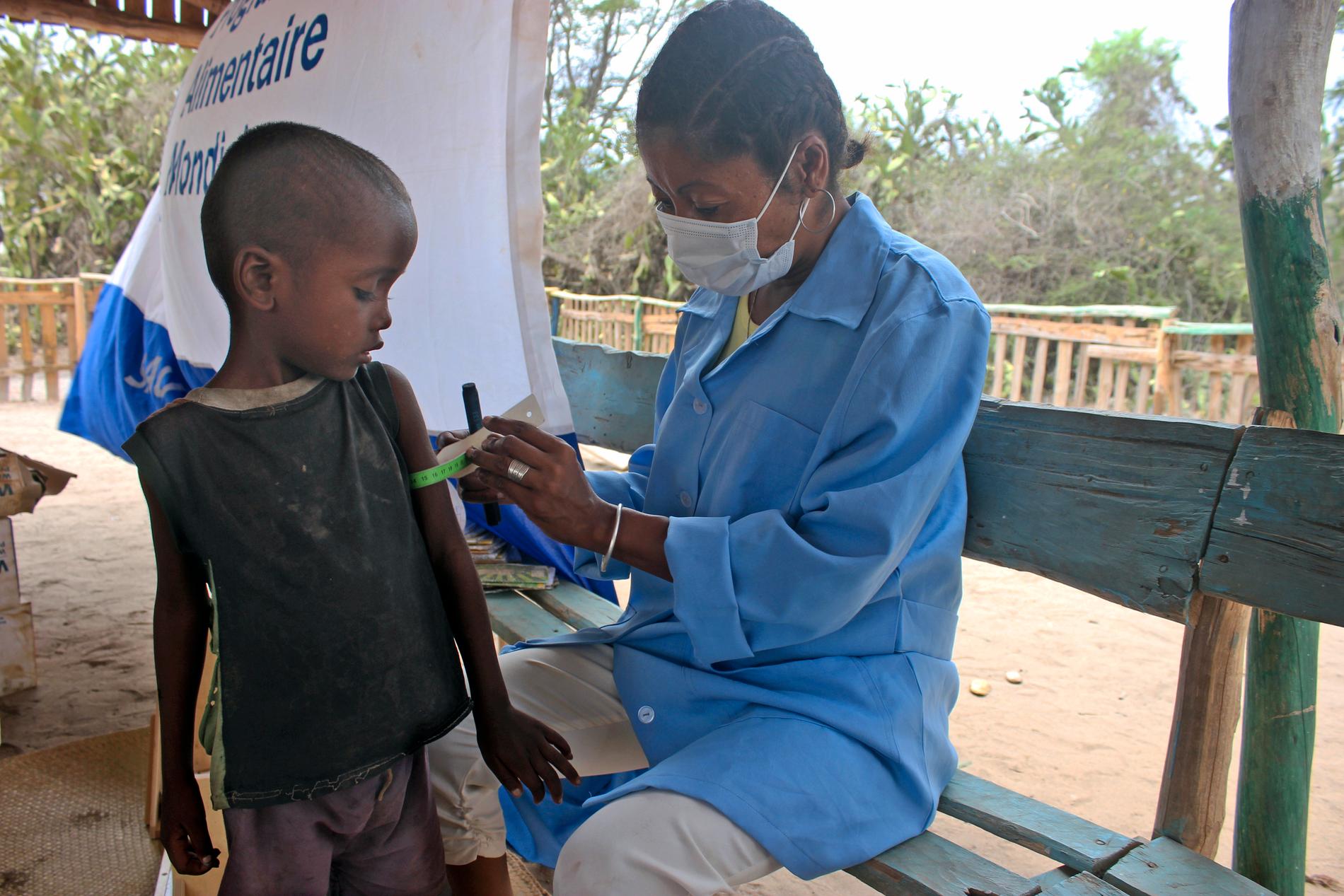 Ett barn i Madagaskar som lider av akut undernäring får hjälp av FN.