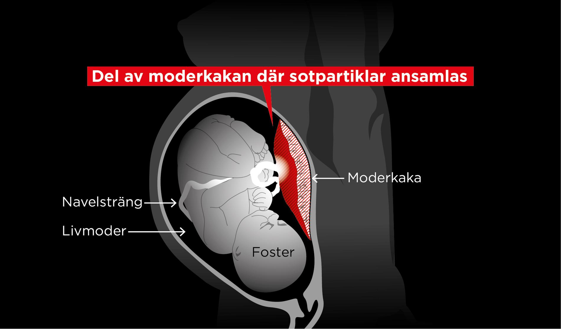 Moderkakan (placentan) delas mellan mamman och barnet. Den så kallade placentabarriären fungerar som ett membran där utbytet av näringsämnen, syre, koldioxid och salter mellan mamman och fostret sker. Partiklarna hittades i vävnadsprover i den del som "tillhör" fostret.