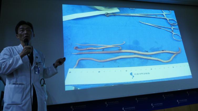 Sydkoreanske kirurgen Lee Cook-jong visar upp fynden i mannens kropp.