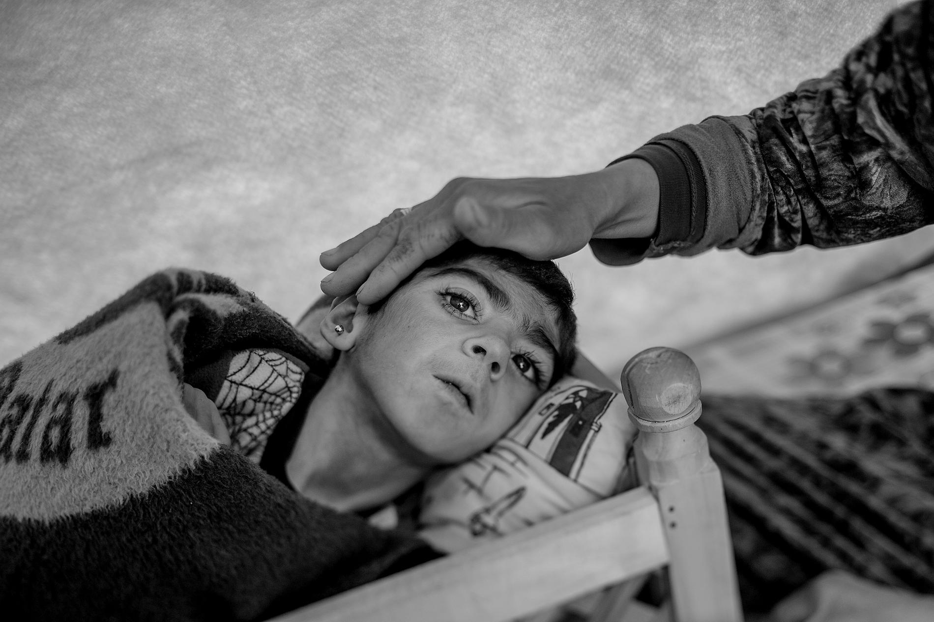 9-åriga Shiraz, flykting från Syrien, har polio Foto: Magnus Wennman/Aftonbladet.