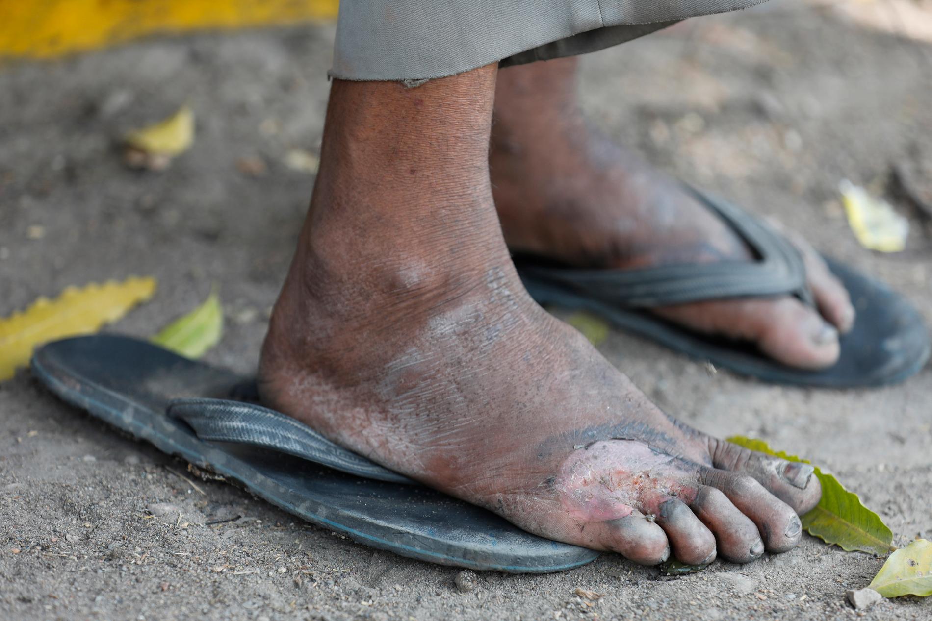 Fötterna tillhör en av de många migrantarbetare som nu måste gå till fots från storstäderna till sina hembyar.