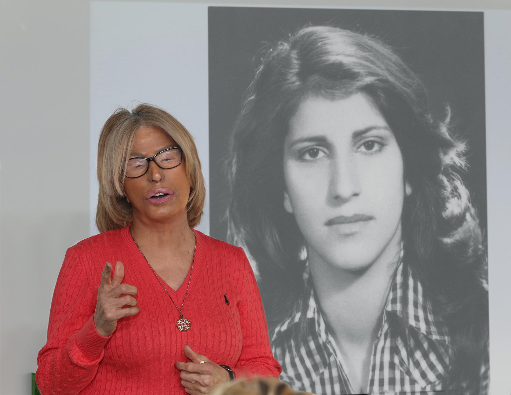 Vid sina föreläsningar visar Maria Rashidi en bild på hur hon såg ut innan syraattacken. 