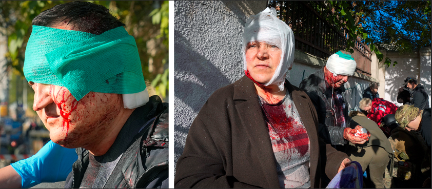 En man med bandage om huvudet och en kvinna och en man tas omhand efter måndagens attack mot den ukrainska huvudstaden Kiev. 