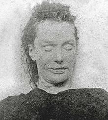 Bild på Elisabeth Stride hos rättsläkaren efter sin död.