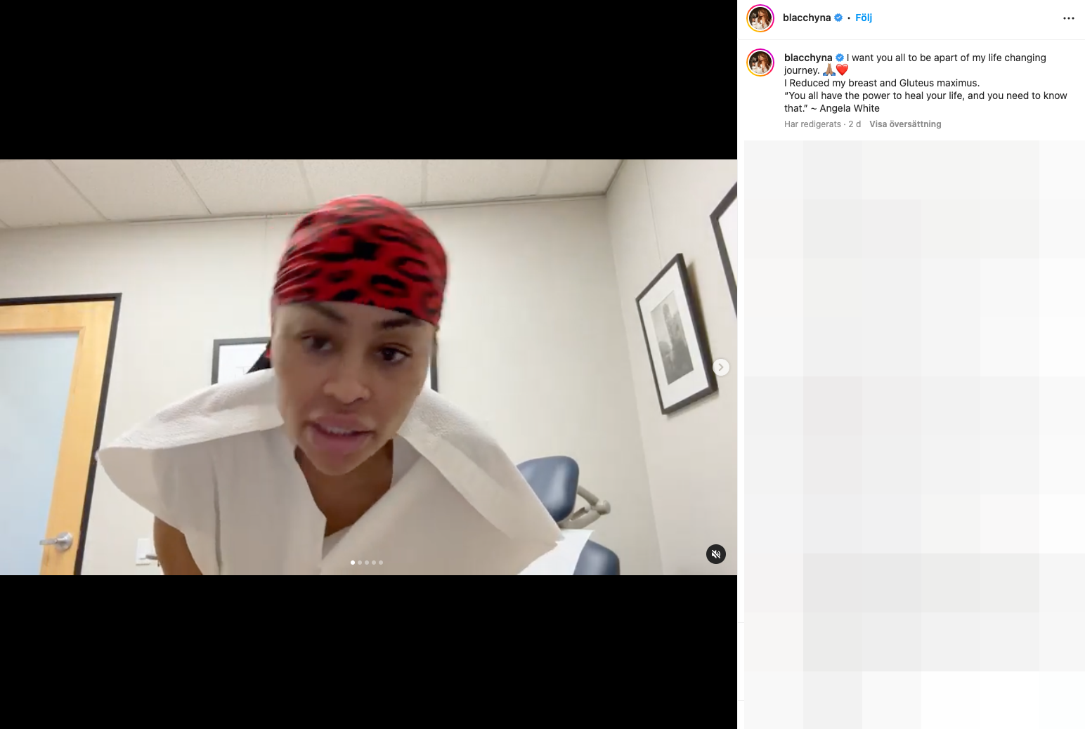 Blac Chyna berättar i en video på Instagram om sina ingrepp.