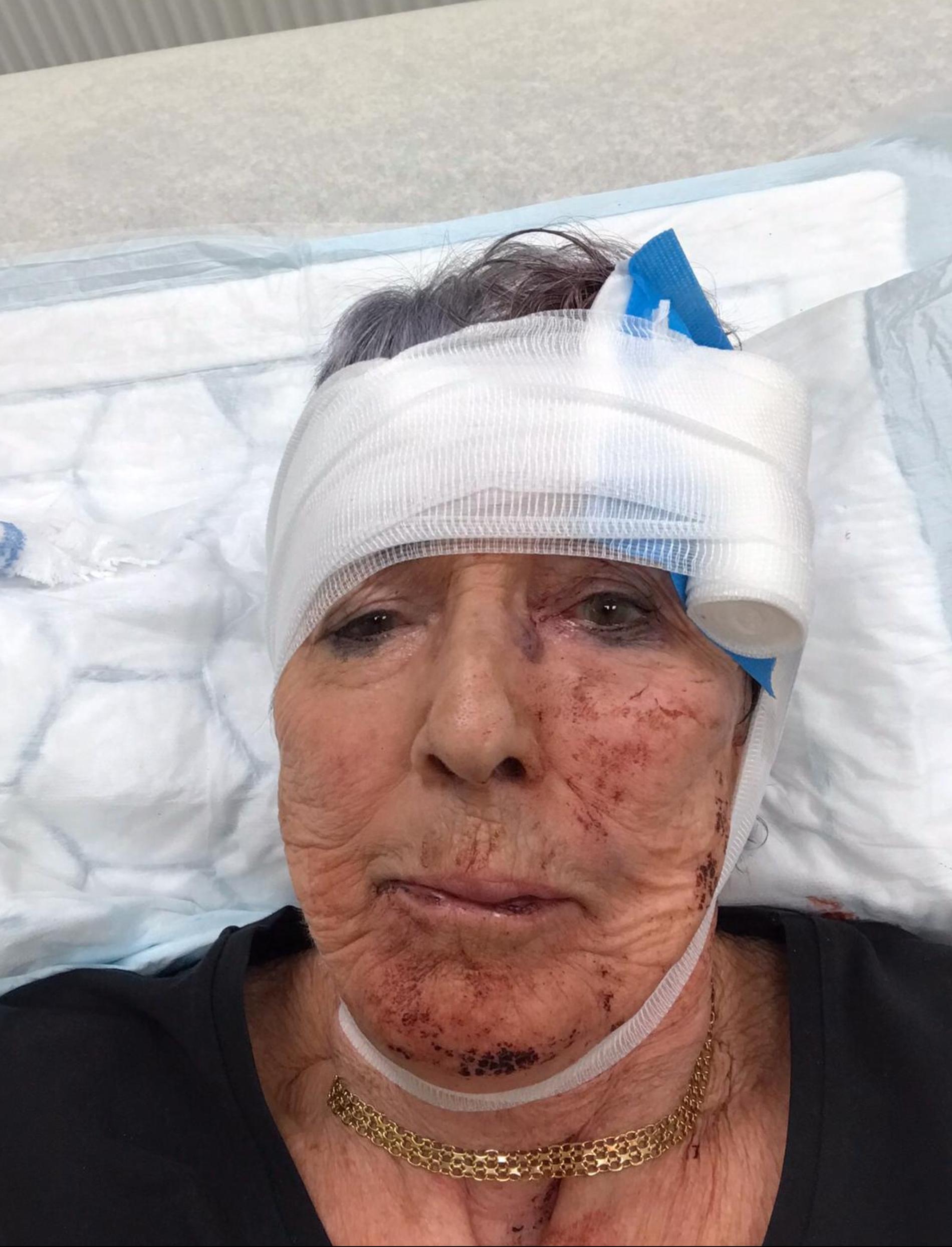 Laila, 81, föll handlöst och slogs blodig mot marken.