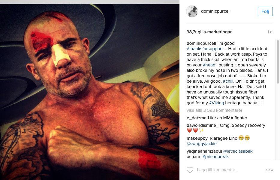 Dominic Purcell visar upp skadorna på Instagram.