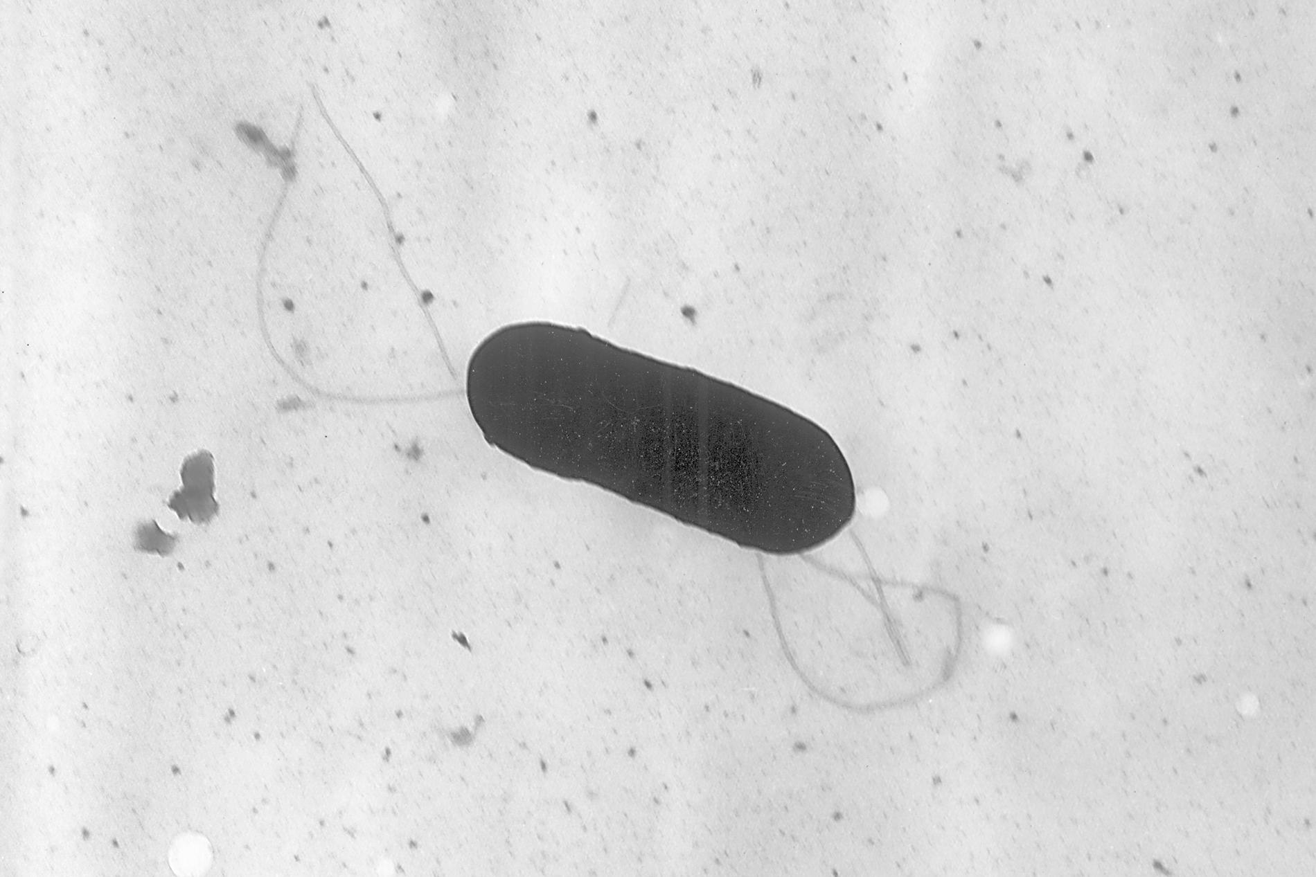 Så här ser listeriabakterien ut i elektronmikroskop. Arkivbild.