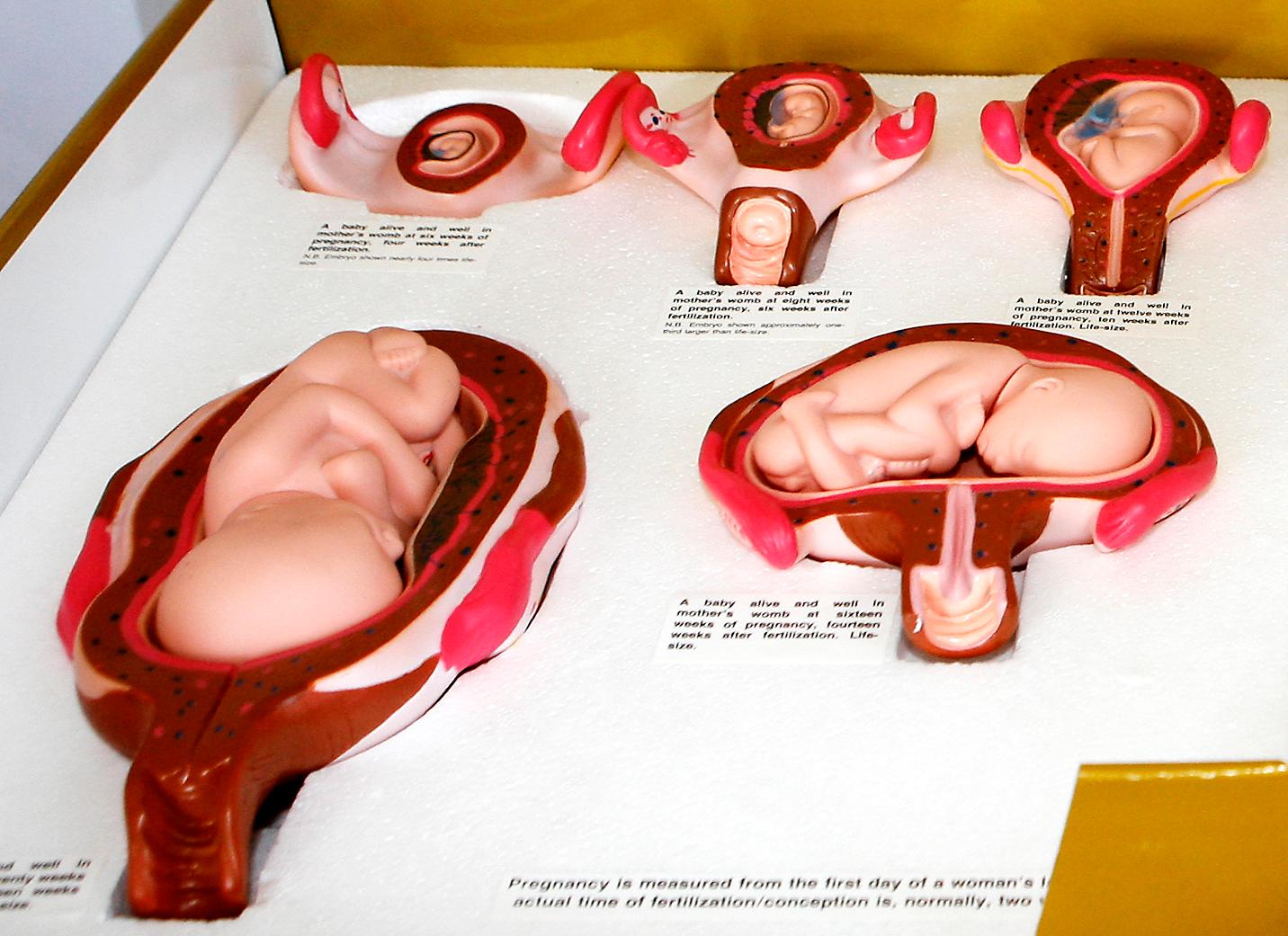 Modeller av foster som används av organisationen Ja till livets kampanjer. Antiabortsrörelsens nya taktik är att kritisera fosterdiagnostik, menar debattören.