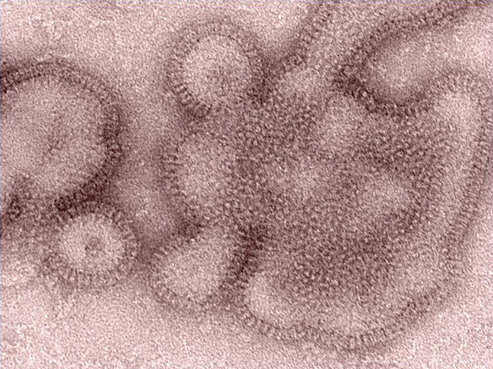 En alltför snabb mutation av influensaviruset A(H3N2) (bilden) har gjort vaccinet mot det verkningslöst för 97 procent av alla som tagit det.