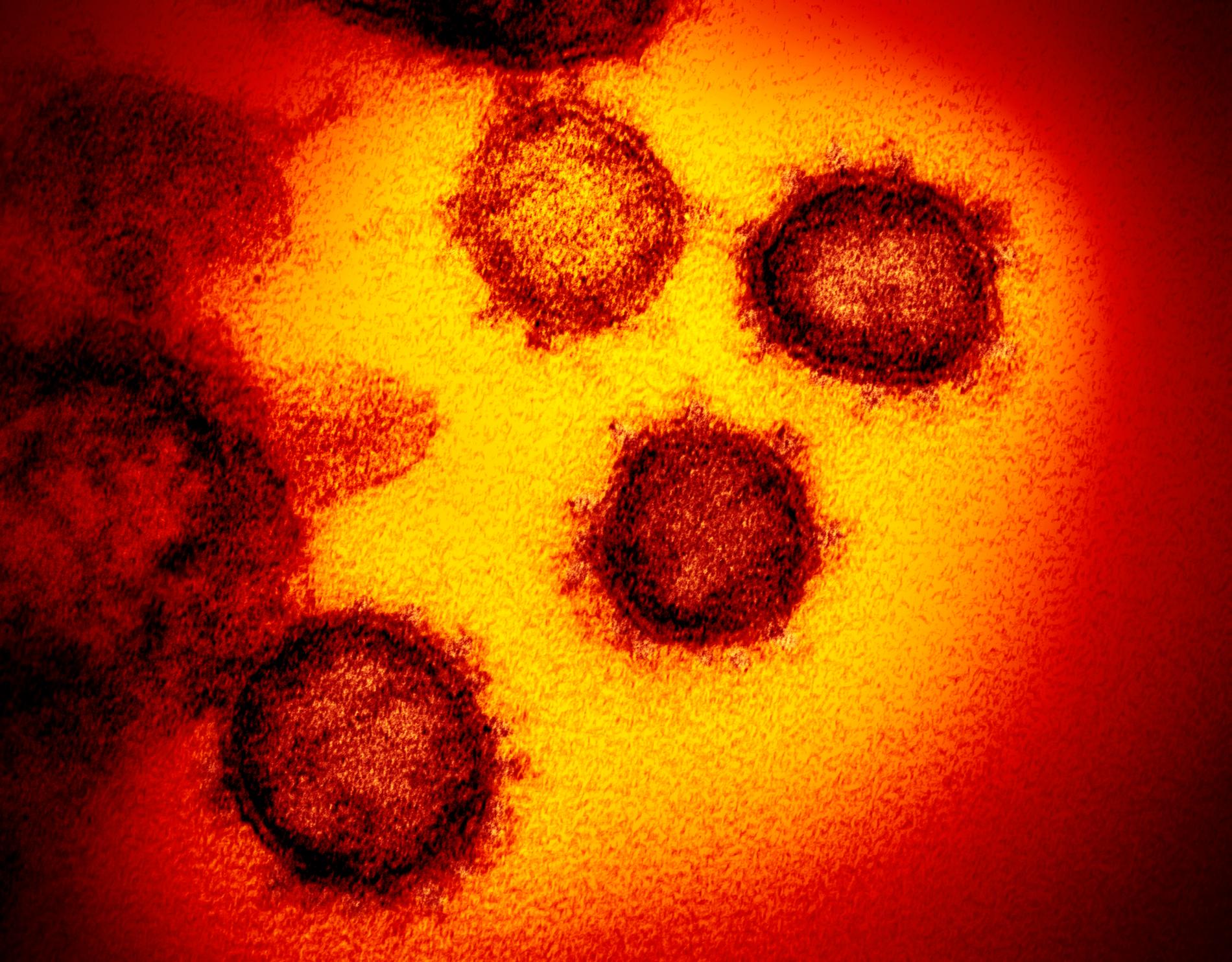 Mikroskopbild på sars-cov-2, som coronaviruset egentligen heter.