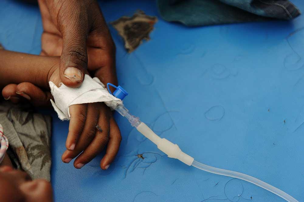Ett barn på ett sjukhus i Somalias huvudstad Mogadishu får intravenös näring. I Somalia och grannländerna riskerar omkring 12 miljoner människor att svälta på grund av extrem torka.