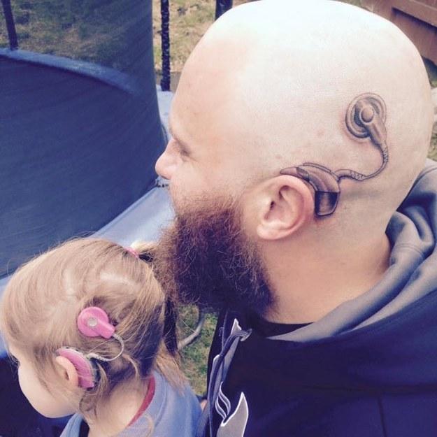 Pappans stöd till dottern – tatuerade ett likadant cochleaimplantat. Foto: Privat